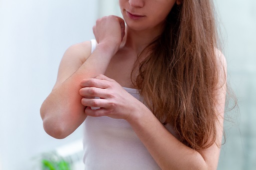 Alergia a Pirazolonas ou Pirazolidinas