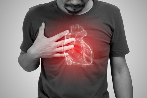 Bloqueio Atrio-Ventricular