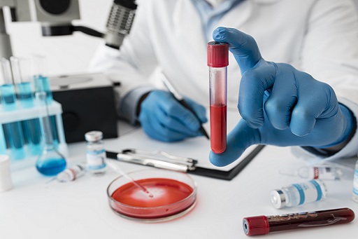 Hiperuricemia Sintomática