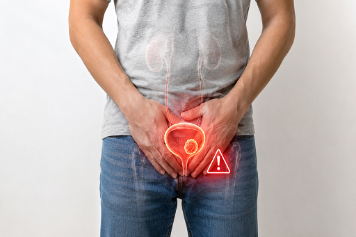 Presença ou Histórico de Tumor na Bexiga