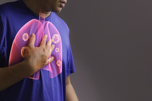 Tuberculose Ativa