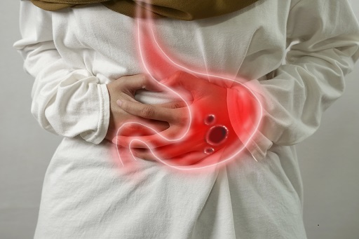 Úlceras gastrointestinais