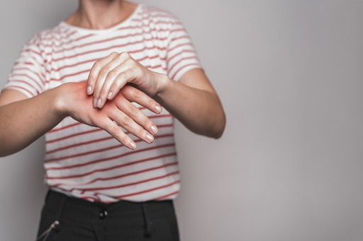 Angioedema