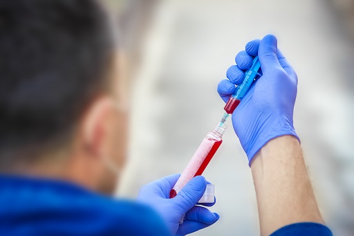 Aumento da enzima CPK em pacientes com doença de crohn