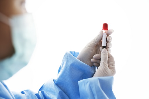 Aumento de ALT em pacientes com artrite reumatoide