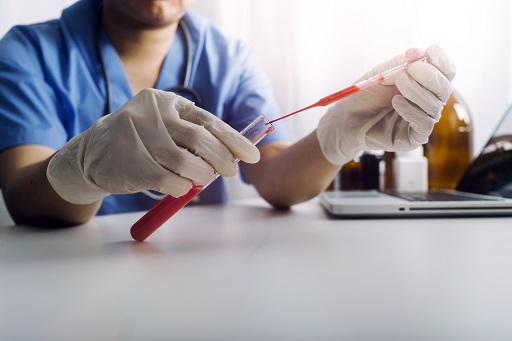 Aumento de ALT em pacientes com dermatite atópica