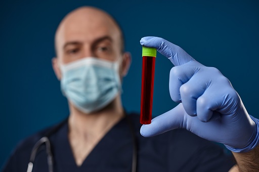Aumento de AST em pacientes com artrite reumatoide
