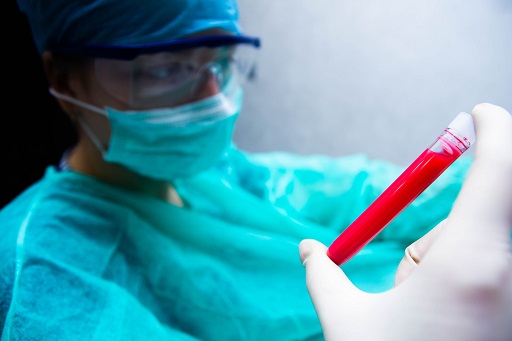 Aumento de AST em pacientes com colite ulcerativa ou retocolite ulcerativa (RCU)