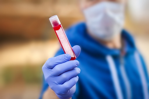 Aumento de AST em pacientes com dermatite atópica