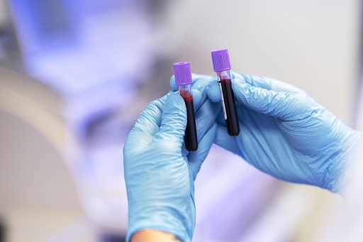 Aumento de aspartato aminotransferase