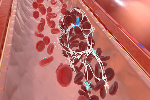 Coagulação intravascular disseminada
