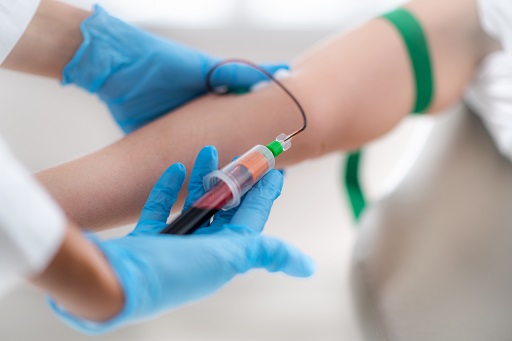 Elevação da proteína C reativa