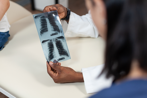 Embolia pulmonar em pacientes com COVID-19