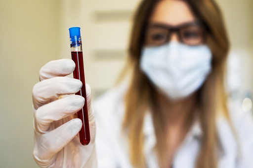 Hipercreatininemia