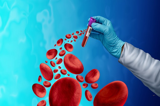 Hipercreatinemia