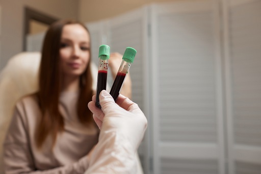 Hipercreatinofosfoquinemia em pacientes com artrite reumatoide