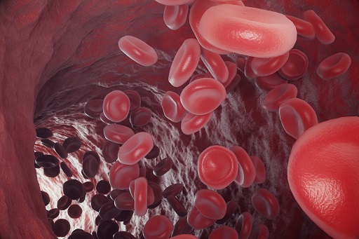 Hiperpotassemia