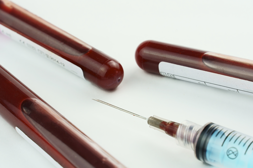 Hipopotassemia