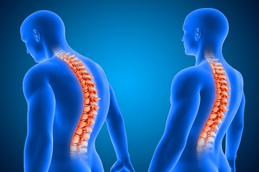 Lesões transitórias da coluna vertebral posterior