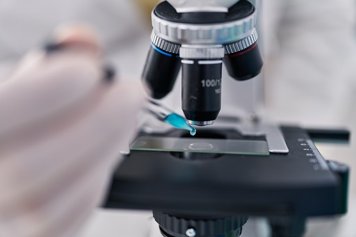 Linfopenia em pacientes com colite ulcerativa ou retocolite ulcerativa (RCU)