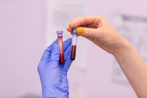 Neutropenia em pacientes com dermatite atópica