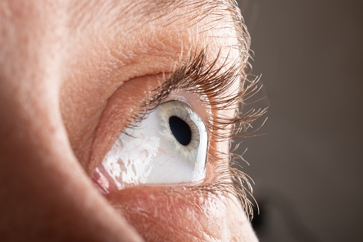 Opacificação