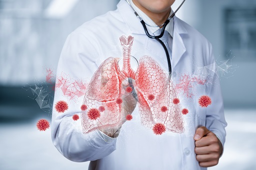 Pneumonia em pacientes com artrite reumatoide