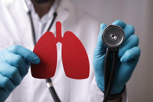 Pneumonia eosinofílica
