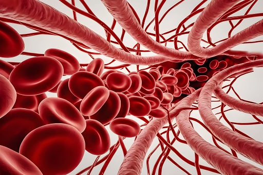 Vasculite