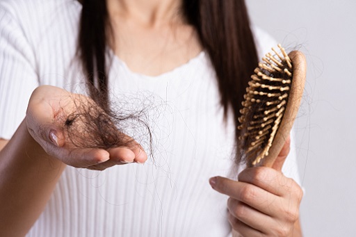Alopecia