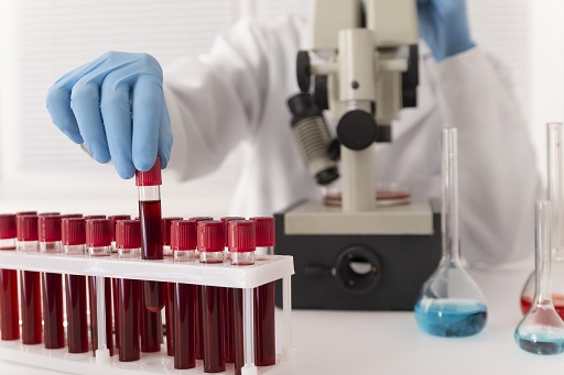 Aumento de creatinafosfoquinase sanguínea