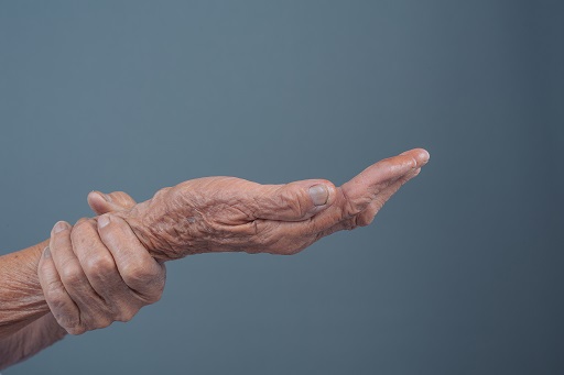 Parkinson